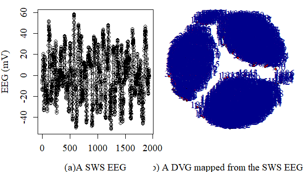 complex network of DS sleep EEG